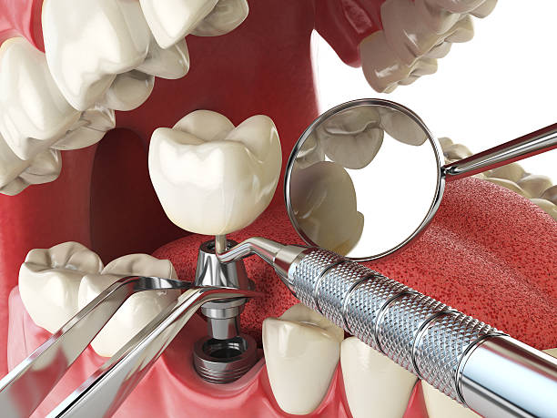 Best Emergency Treatment for Toothache in Cavalier, ND